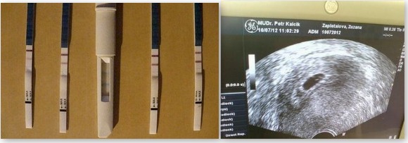1.trimestr - pozitivní těhtotenský test a UTZ v 6.týdnu těhotenství