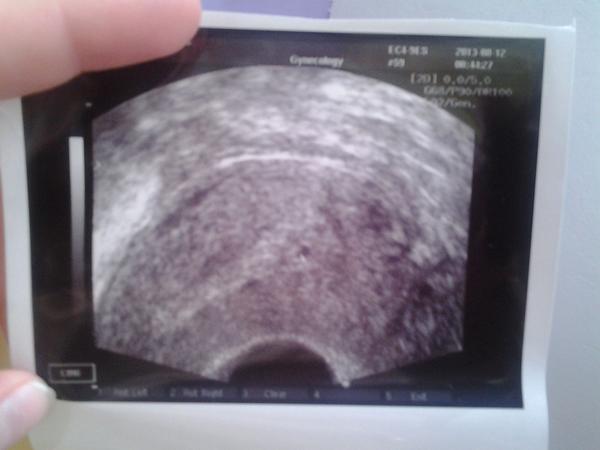 Přidávejte Vaše ultrazvuky