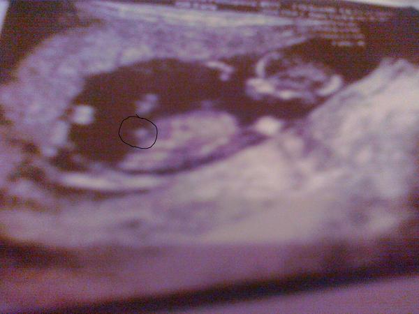 13tt - může to být polaví? 