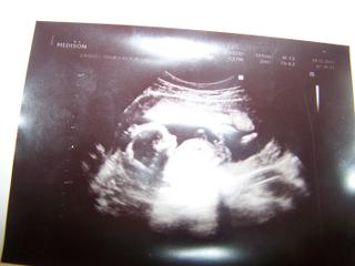 Myslíte, že to může být holčička nebo je to jasný kluk?