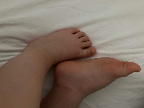 Výbava na léto. Jaké botičky pořídit?