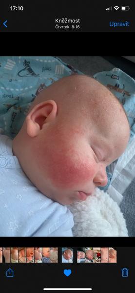 Je to kvasinka nebo něco jiného?