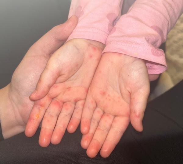 První návštěva s 7. nemocí: Je lékař nutný?