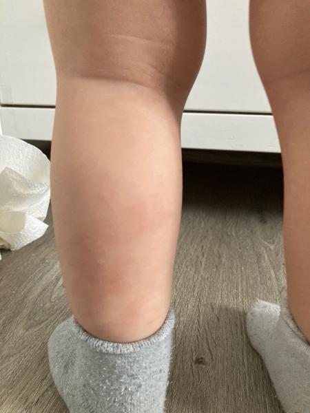 Růst zoubků nebo něco jiného?