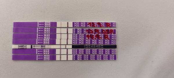 Pozitivní testy, ale nejsem těhotná. Mám cystu?