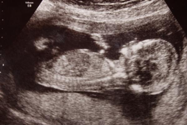 Co tipujete za pohlaví?