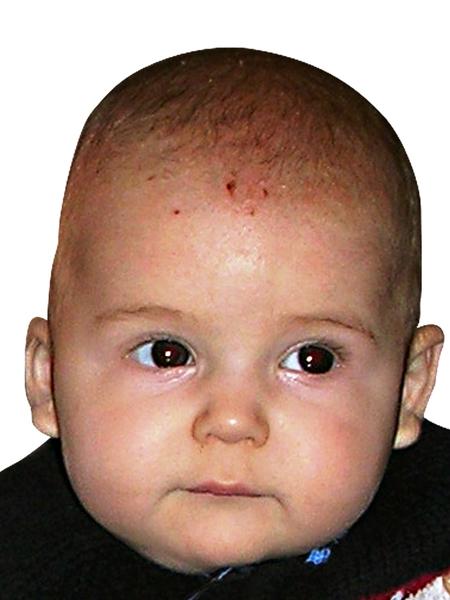 Mělo vaše děťátko poškrábanou hlavičku? Jak jste to řešily? Poradíme ostatním maminkám?