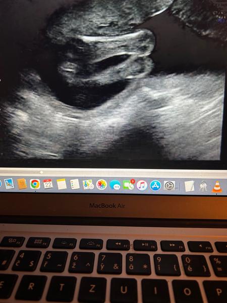 Holčička nebo chlapeček? Co vidíte na obrázku?