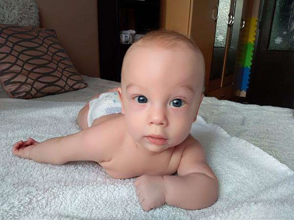 Menší očičko u 4měsíčního dítěte - co s tím?