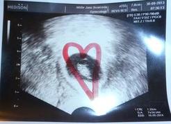 ELISA a zjištění těhotenství