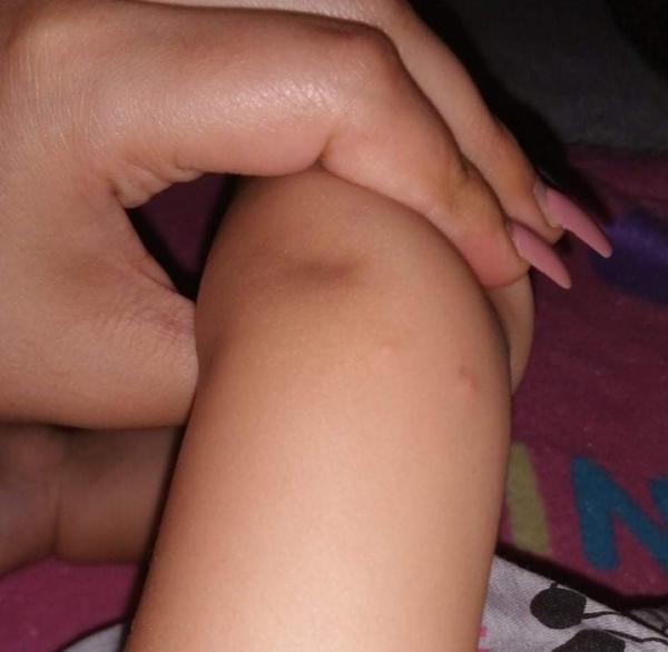 Pupínky. Co to může být?