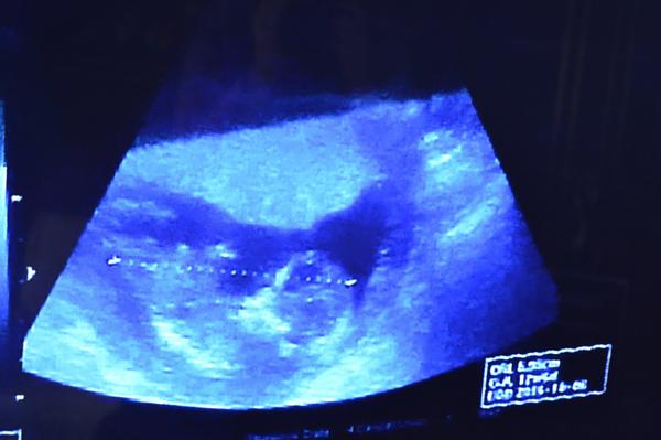 Velikost plodu ve 13. týdnu