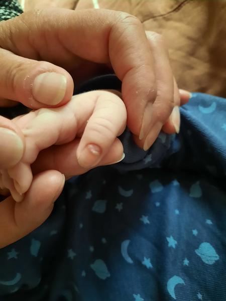 Jak řešit problémy se skvrnami na nehtech syna?