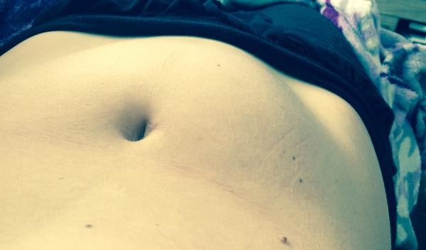 Vypouklé bříško na jednu stranu