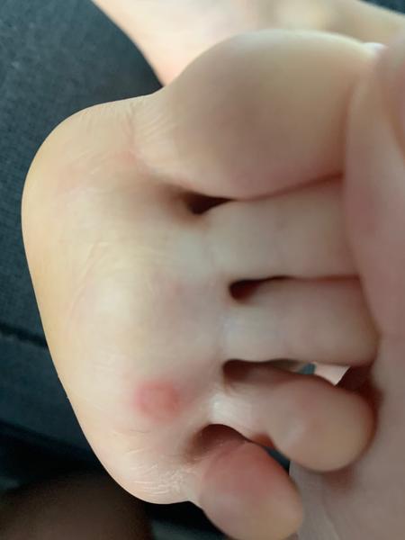 Angína nebo spíše sedmá nemoc?