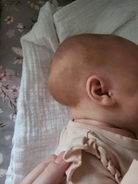 Skafocefalie u dětí. Je důvod k obavám?