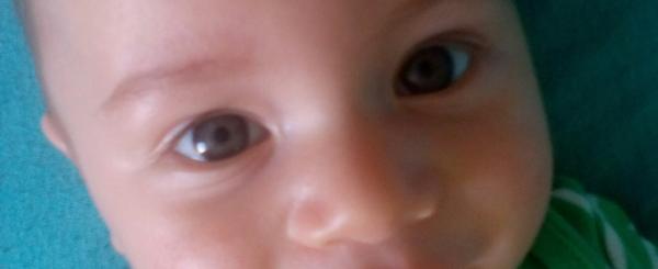 Jak vypadají očička než zhnědnou nebo zmodrají?