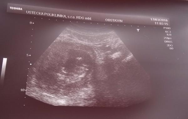 Podle UTZ mi přijde prcek malý