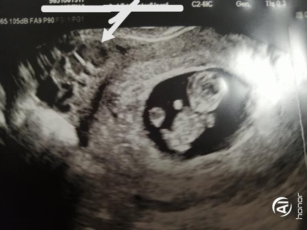 Ultrazvuk. Mohl byste mi, prosím, poradit?