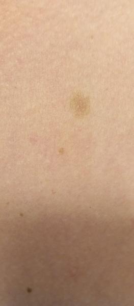 Piha. Proč je takto ohraničená?