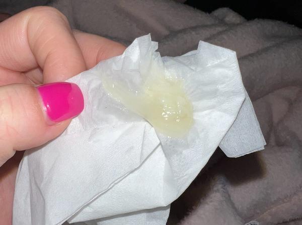 Jedná se o zátku nebo pouze výtok?