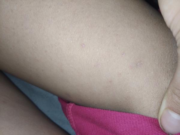 Svědění nohou: Jak rozeznat, zda je to svrab?