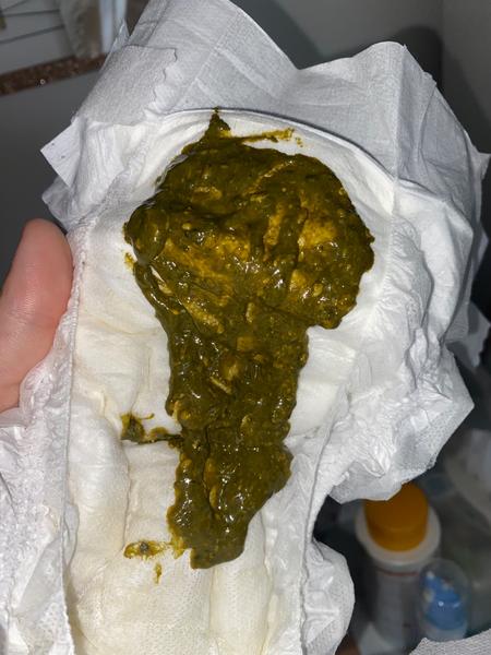 2měsíční miminko - problém s UM. Je takové vyprazdňování v pořádku?