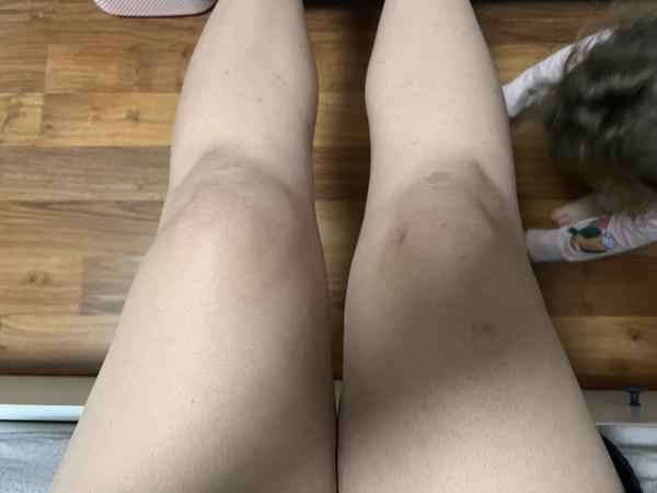 Bolest a otok kolene: Co by to mohlo být?