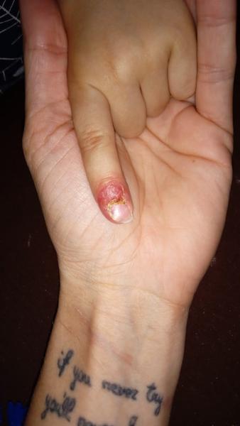 Co přinesl syn ze školky? Identifikujte neznámou věc!