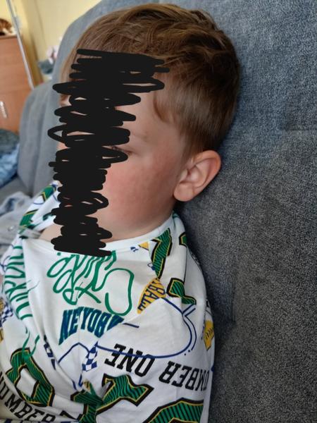 Vyrážka. Jedná se o pátou nemoc?