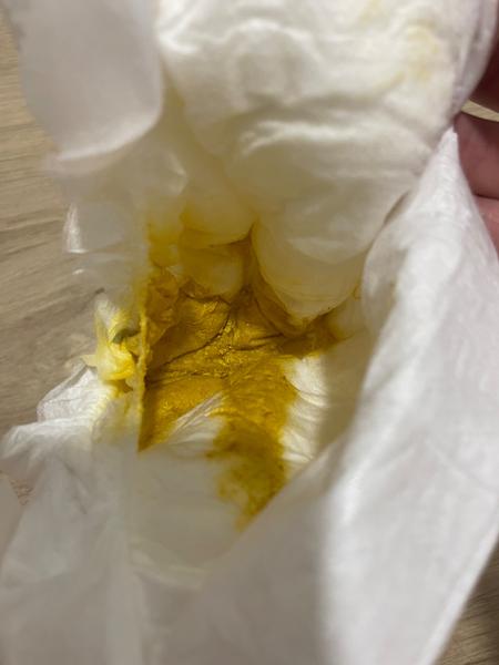 Stolice kojence. Je konzistence v normě?