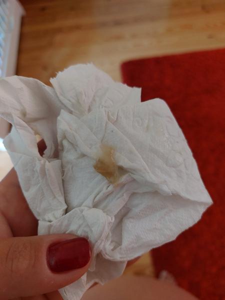 Je to hlenová zátka?