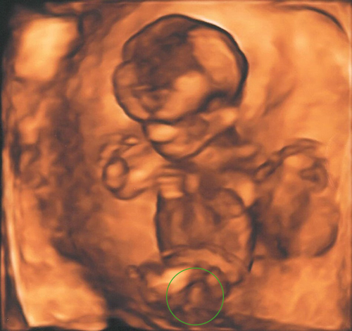 Vidíte to také? Chlapeček?