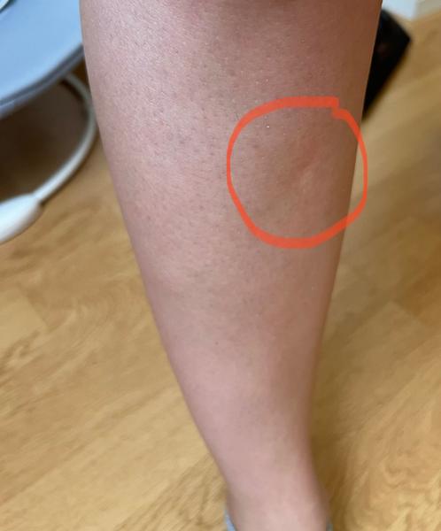 Může být tento zdravotní problém vážný?