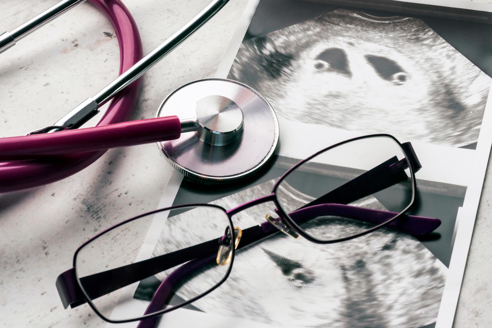 Syndrom mizejícího dvojčete Syndrom mizejícího dvojčete