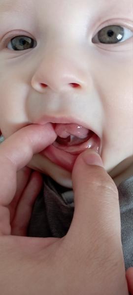 Může být protivnost a slinění znakem růstu zubů?