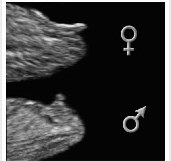 Je to podle ultrazvuku holka nebo kluk?