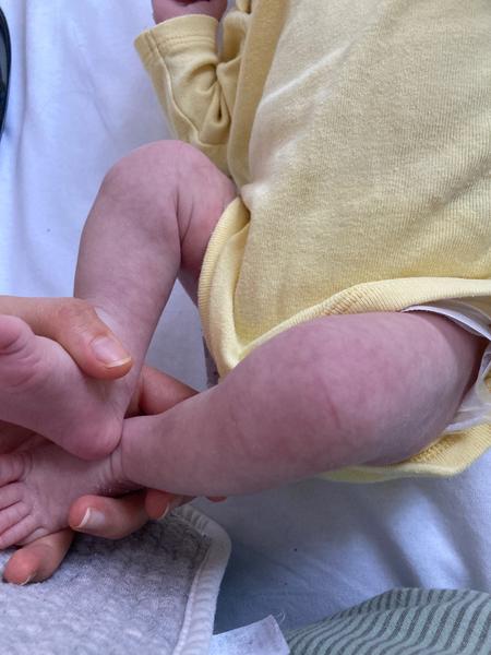 Mramorová kůže u novorozence. Čím by to mohlo být? Obávat se něčeho?