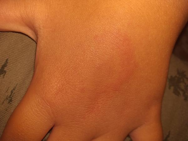 Dotaz-štípnutí. Je to ještě reakce?