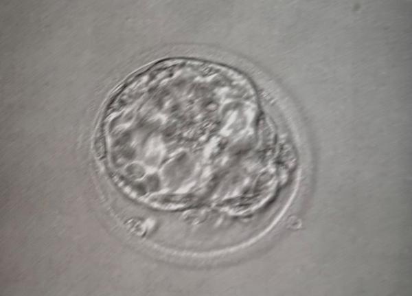 Kvalita embrya. Lze posoudit z fotografie?