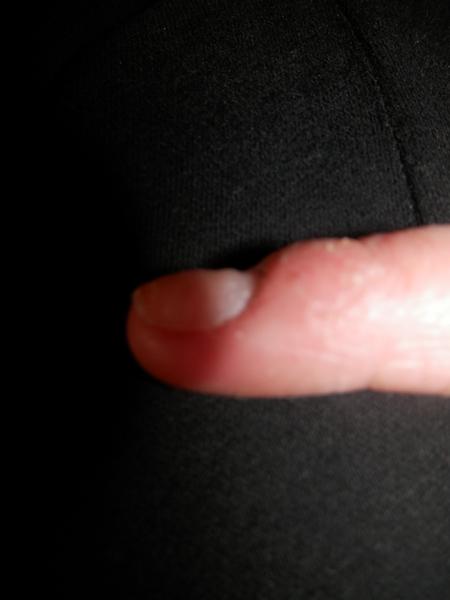 Zvlnění nehtů, může to být po gelových nehtech?