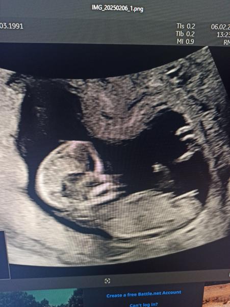 1. screening. Jaké pohlaví?