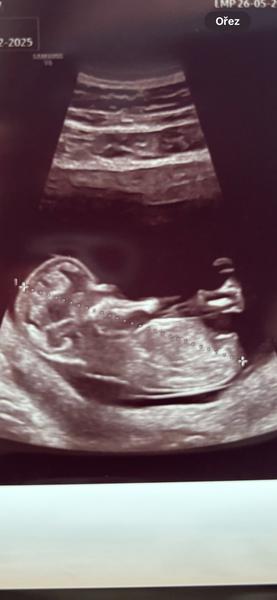 Poznáte prosím pohlaví?