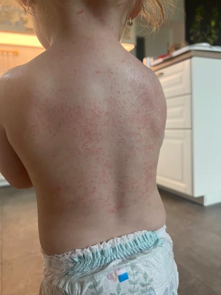 Je to potničky nebo nemoc páté či šesté?

