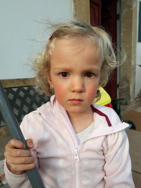 Nachlazení a vyrážky. Může to být pátá nemoc?