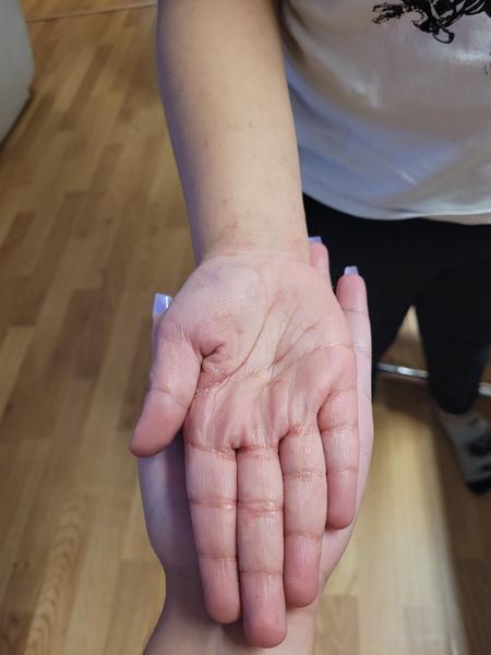 Svědivé pupínky. Co by to mohlo být?