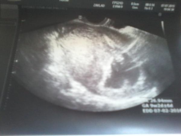 Stalo se, že by na UTZ v 10tt bylo mimčo špatně vidět?