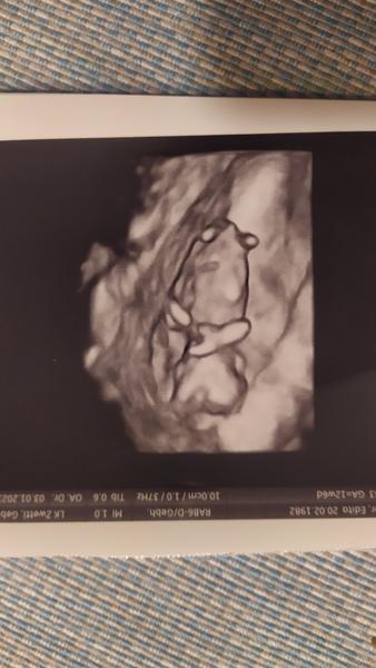 Jak zjistit pohlaví z ultrazvukových fotografií?