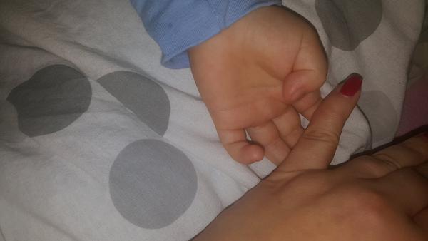 Podrážděné dlaně. Co byste doporučila na zklidnění?