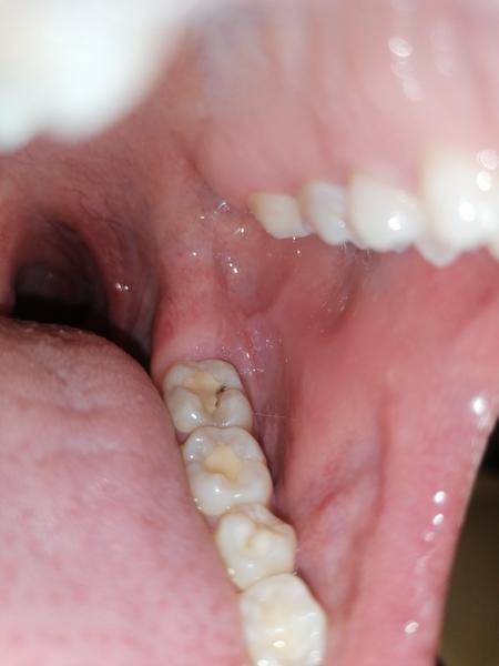 Kaz na zubu, i když jsem byla na kontrole. Je možné, že to pan doktor neviděl?